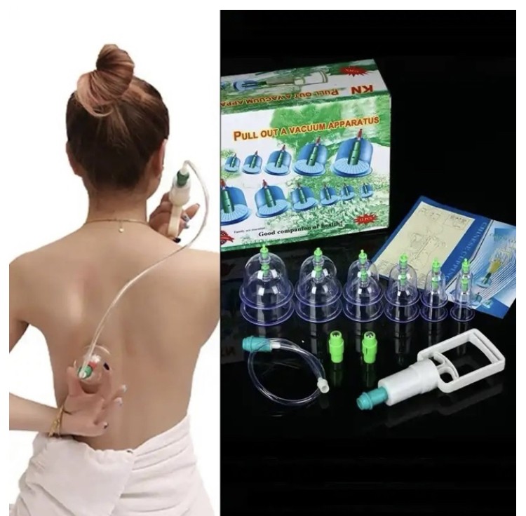 Ensemble de thérapie domestique Chi ping, pompe à ventouse sous vide, optique ABS, 12 canettes, massage, standardisation, masseur d'acupuncture, soins de santé