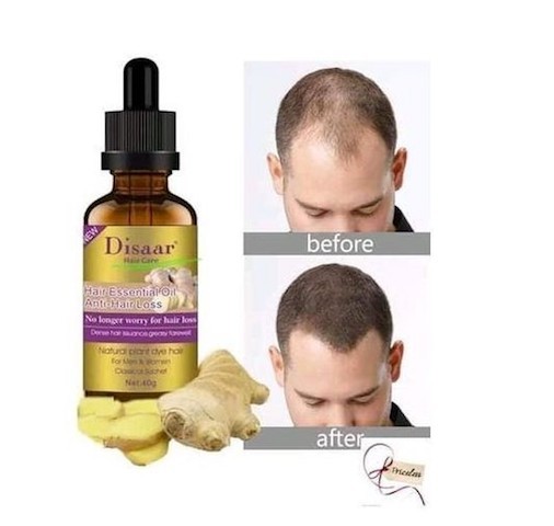Disaar Huile essentielle croissance cheveux