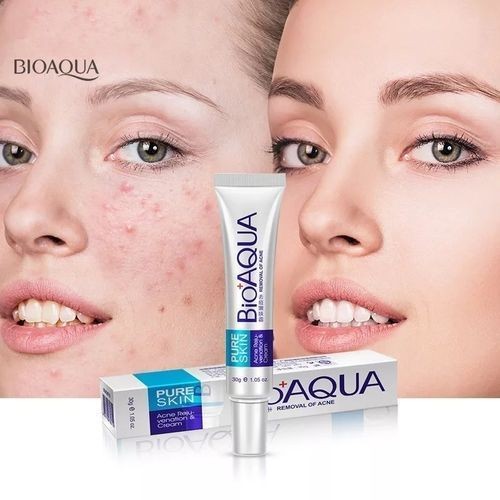crème Anti-acné pour le visage traitement des points noirs-30g Bioaqua