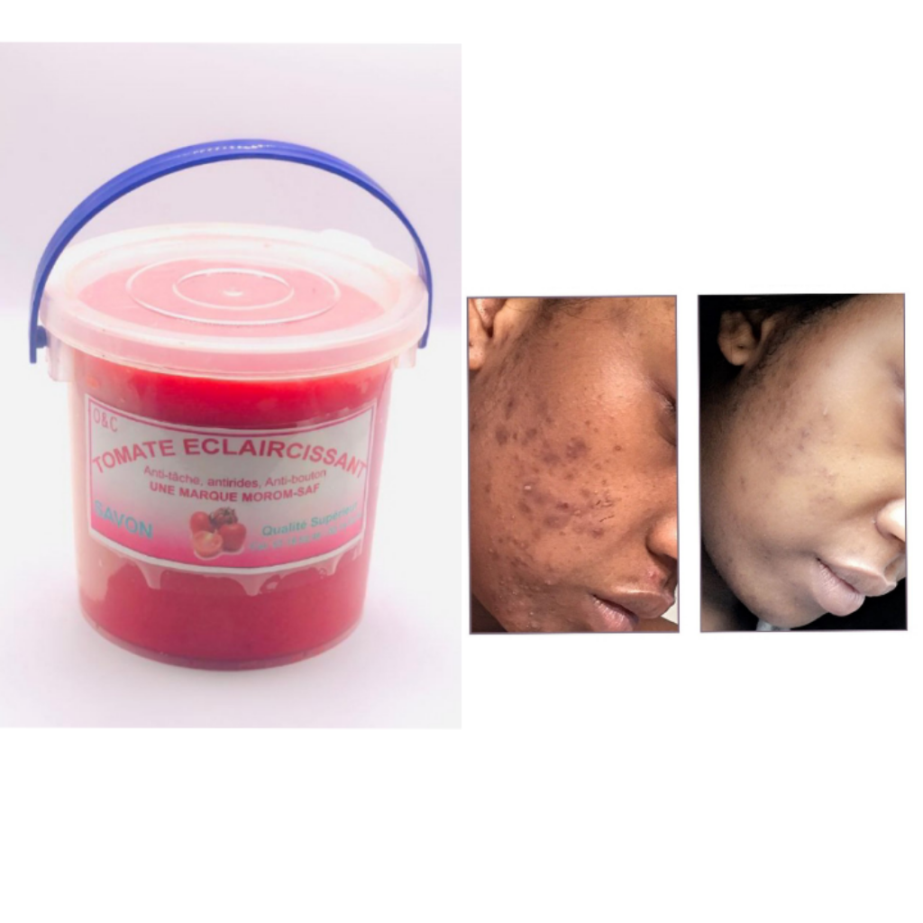 SAVON bio TOMATE ECLAIRCISSANT anti boutons et tâches